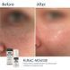 ПЕНКА ДЛЯ УМЫВАНИЯ BRADERM KURAC CLEANSING MOUSSE BRADERM7 фото 2